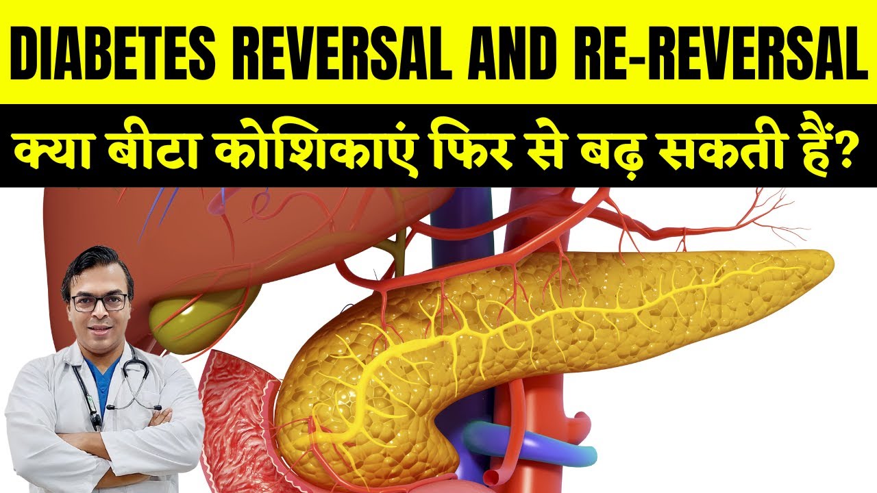 DIABETES REVERSAL AND RE-REVERSAL | क्या बीटा कोशिकाएं फिर से बढ़ सकती ...