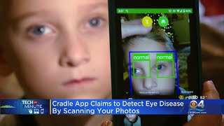 App Claims To Detect Eye Disease By Scanning Photos screenshot 3