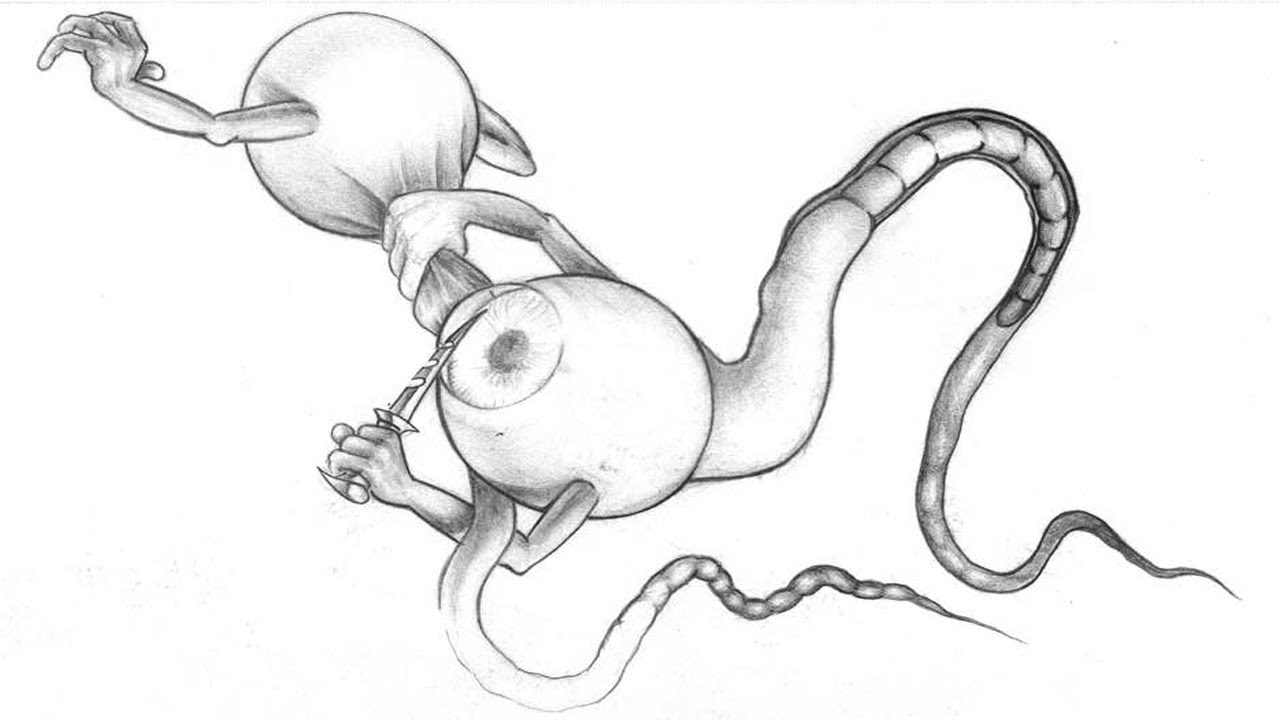 PELEA DE ESPERMATOZOIDES