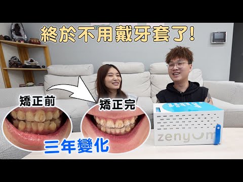我戴了3年隱形牙套，牙齒從亂到整齊的驚人變化！【Bobo TV】