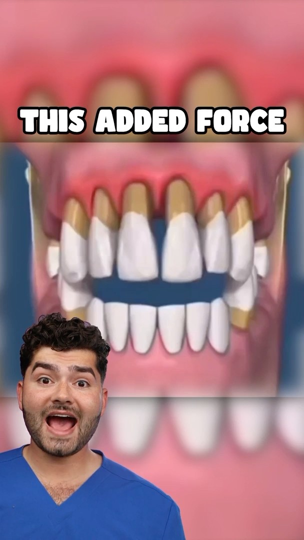 What Would Happen If You Stop Brushing Your Teeth!?