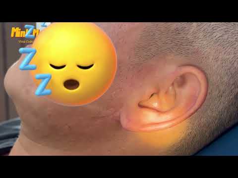 Anh ngại lắm, em cứ moi móc ráy tai đại đi- earwax- Minh MenHair