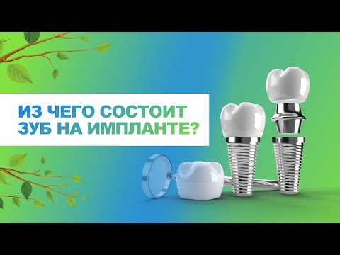 🦷 Из чего состоит зуб на импланте (имплант+абатмент+коронка)