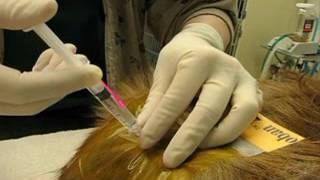 Epidural Analgesia Injection