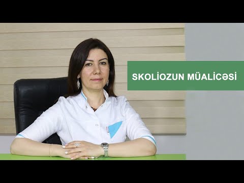 Skoliozun müalicəsi