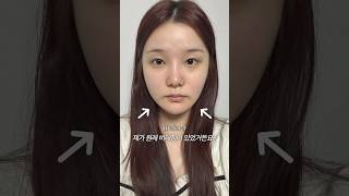 울쎄라 600샷 한달 후기 #shorts