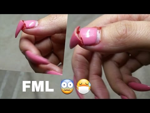 nails hurt after acrylic｜TikTok Search