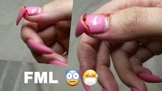 I RIPPED MY ACRYLIC NAIL OFF | PAIN | WORST PAINFUL EVER | I PASSED OUT