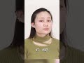 方脸下颌角宽太难了，你有这样的问题吗？  #方脸 #案例分享 #变美 #整容 #下颌角 #cheekbones