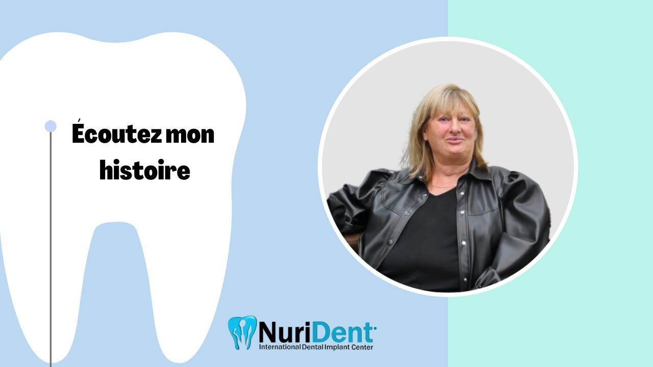 Implants basaux seulement en 3 jours - Patient de France (BasalFix)