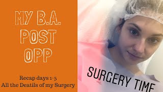 Breast Aug Recovery: Details of what I got and the first 5 Days post Opp