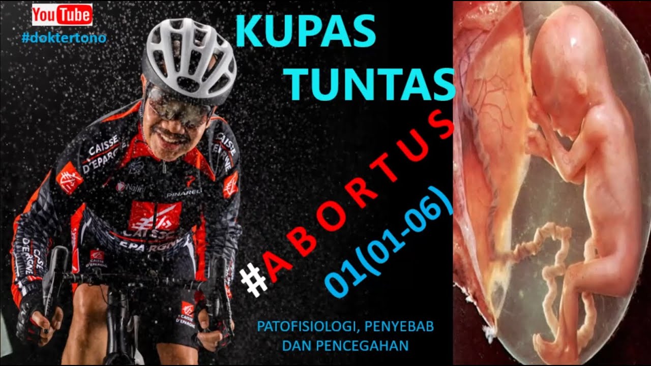 Kupas Tuntas ABORTUS #1 | SERI ABORTUS