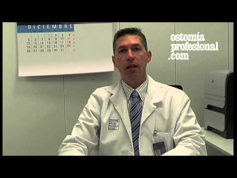 Video: ¿Qué es una colostomía terminal?