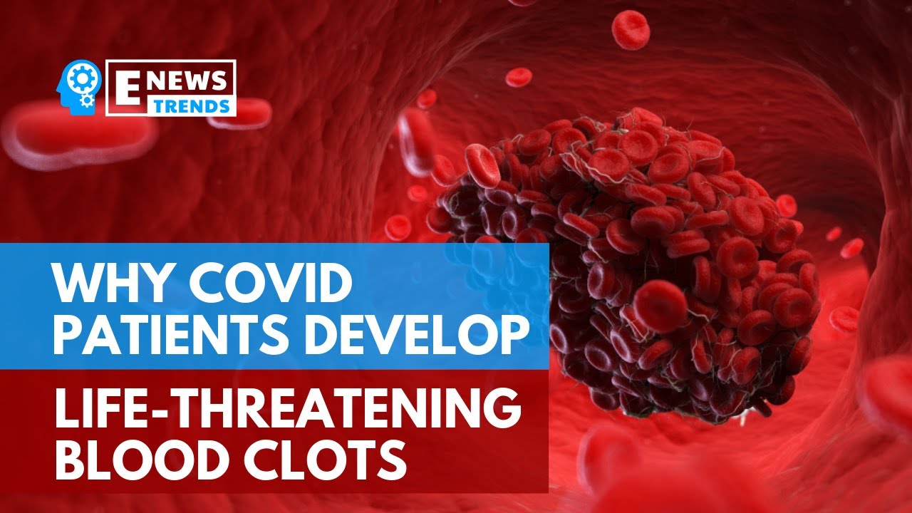 Why COVID19 Patients Develop LifeThreatening Blood Clots YouTube