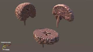 Brain cross sections