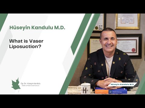 What is Vaser Liposuction?