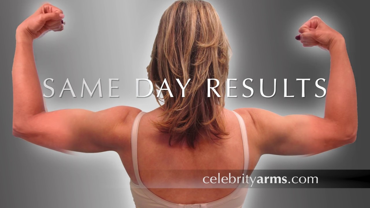 Celebrity Arms™ - 19| High-Definition Ultra-Complete Arm Liposuction