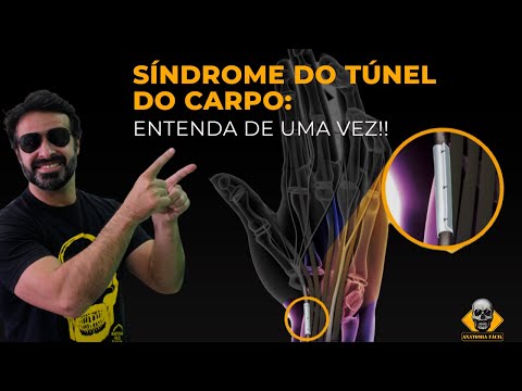 SÍNDROME DO TÚNEL DO CARPO APRENDA DE MANEIRA DESCOMPLICADA!