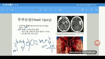 12 1 1 신경계외상환자의 간호1 2