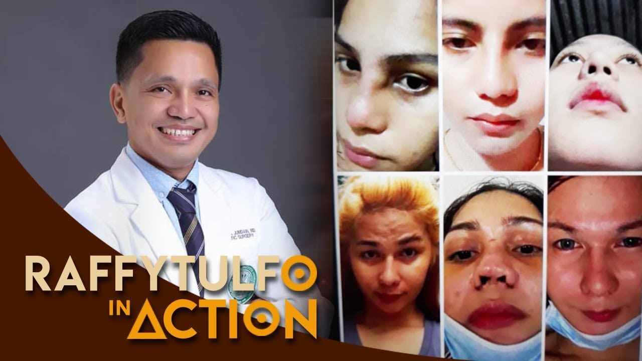 PALPAK NA NOSE JOB, INIREKLAMO NG PASYENTE NG PLASTIC SURGEON NA ITO!