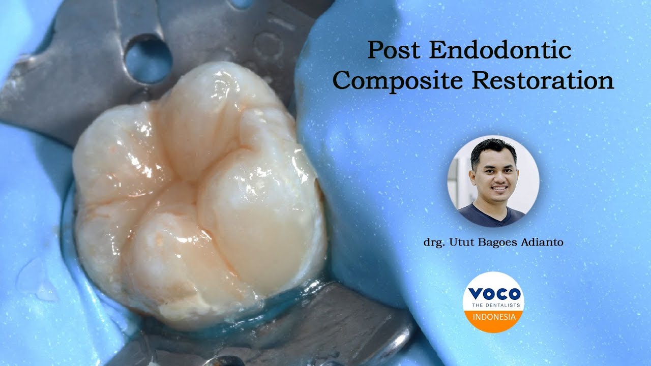 Post Endodontic Restoration Resin Composite AMARIS: Clinical Case ǀ VOCO GmbH