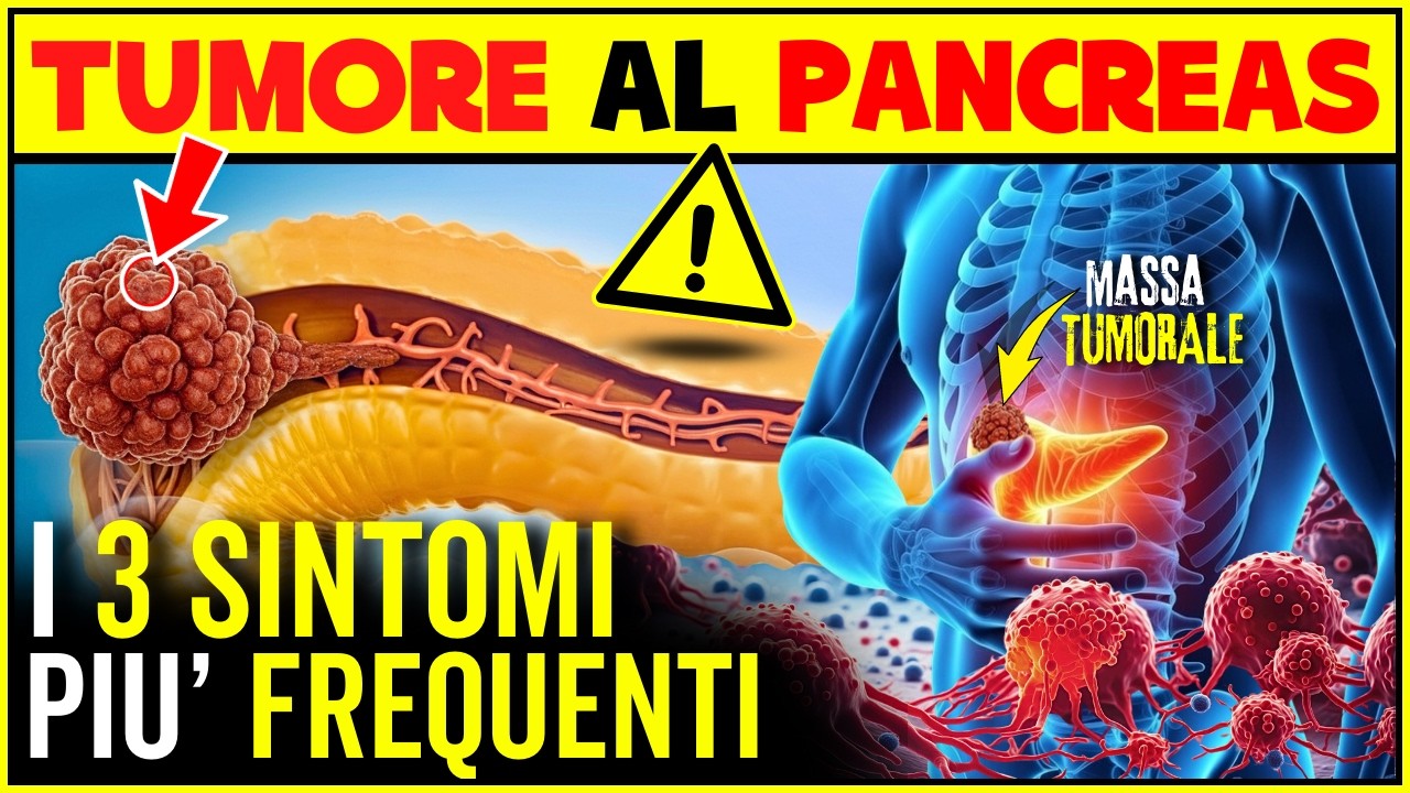 TUMORE AL PANCREAS: I 3 Sintomi Più Frequenti - YouTube