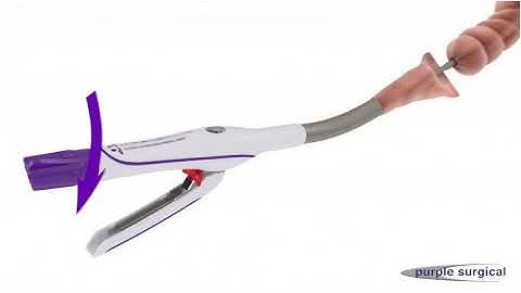 The Ultimate Circular Stapler with Dual Safety & Tilt Top Anvil on Vimeo1