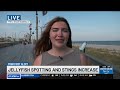 Jellyfish stings on the rise across the Grand Strand
