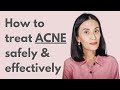 Safe and effective treatment for mild to moderate acne  dr gaile robredovitas