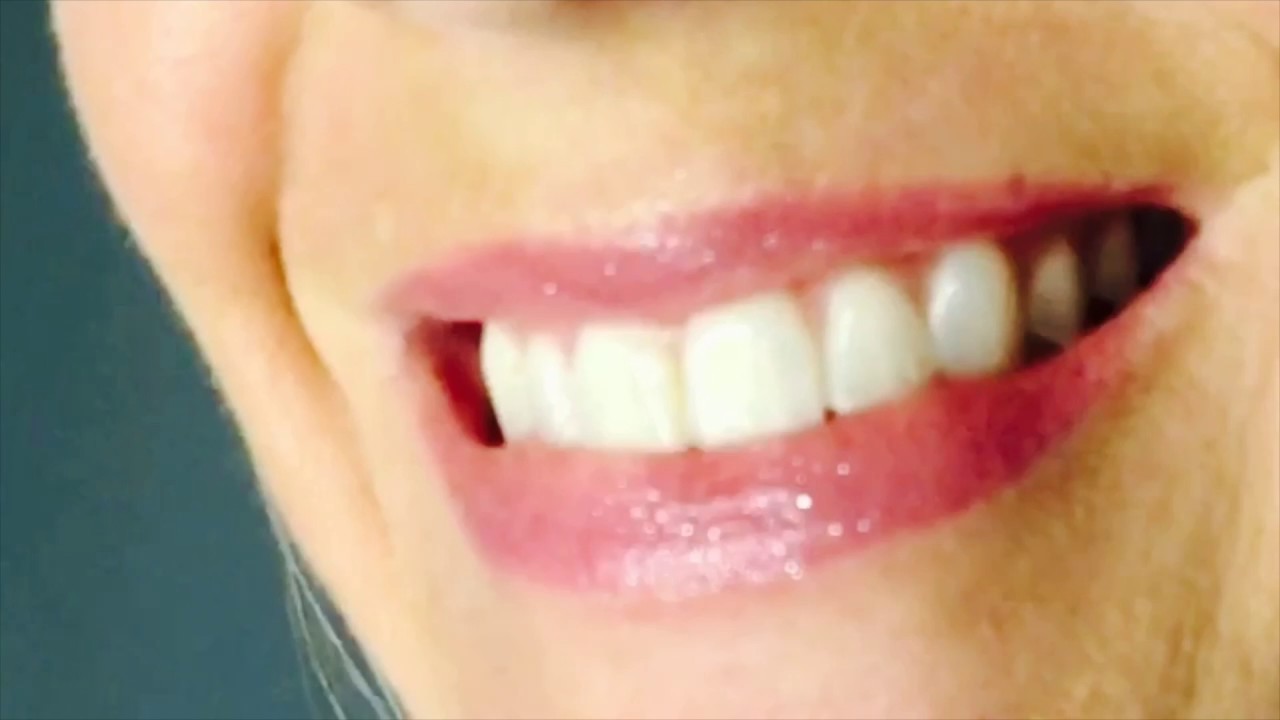 LipSense Silver Glitter Gloss