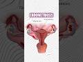 Heavy Bleeding &amp; Period Pain? Watch This! 🛑
