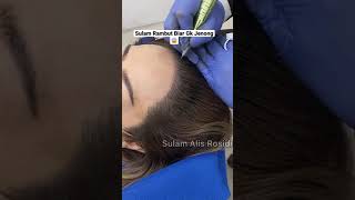 Sulam Rambut Biar Gak Jenong 😭😱