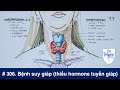 #306. Bệnh suy giáp (nhược giáp) do thiếu hormone tuyến giáp