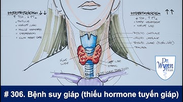 #306. Bệnh suy giáp (nhược giáp) do thiếu hormone tuyến giáp