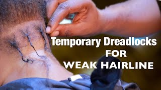 The Best Method Used To Install  Temporary Dreads On (4C) Weak HairLine.