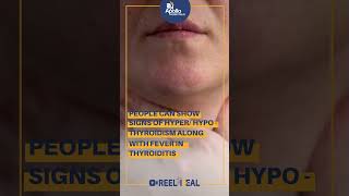 Download lagu What Are The Warning Signs Of Thyroid Problems? Dr. Ravi Sankar Erukulapati, En Mp3 Video Mp4