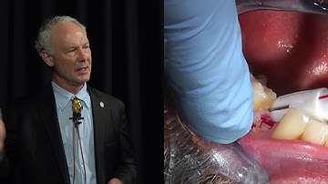 The Easy Extract System