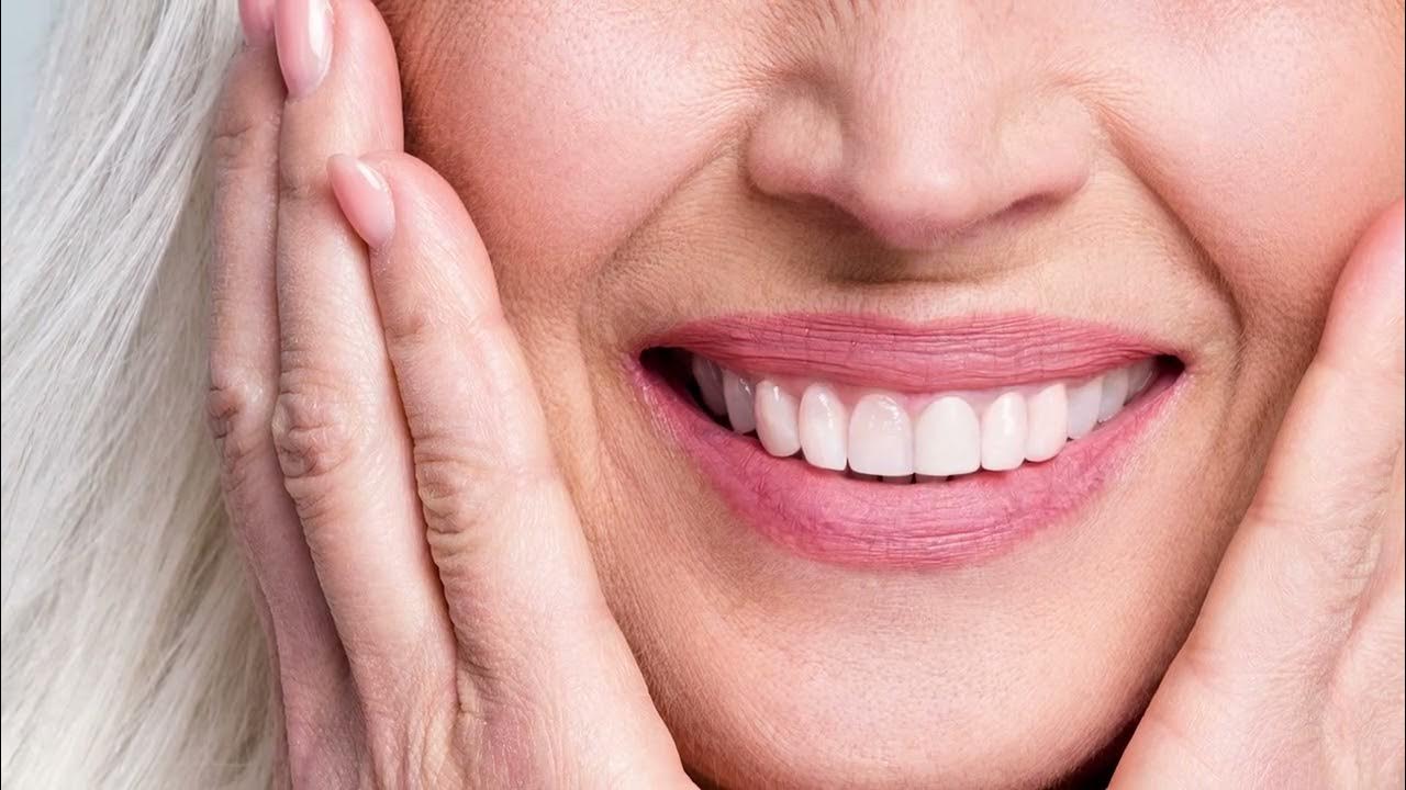 Can Veneers Be Whitened? YouTube