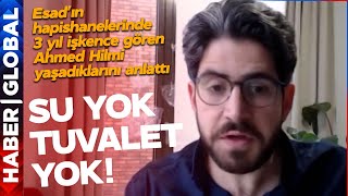 Esadın Hapishanelerinde 3 Yıl İşkence Gördü, 35 Kilo Verdi Annem Beni Tanıyamadı
