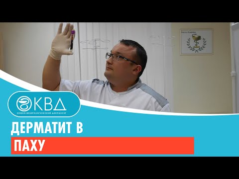 Дерматит в паху. Клинический случай №114