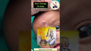 Burn therapy on baby / Dangerous treatment / Superstitions / Malpractice / Awareness video / Bengali