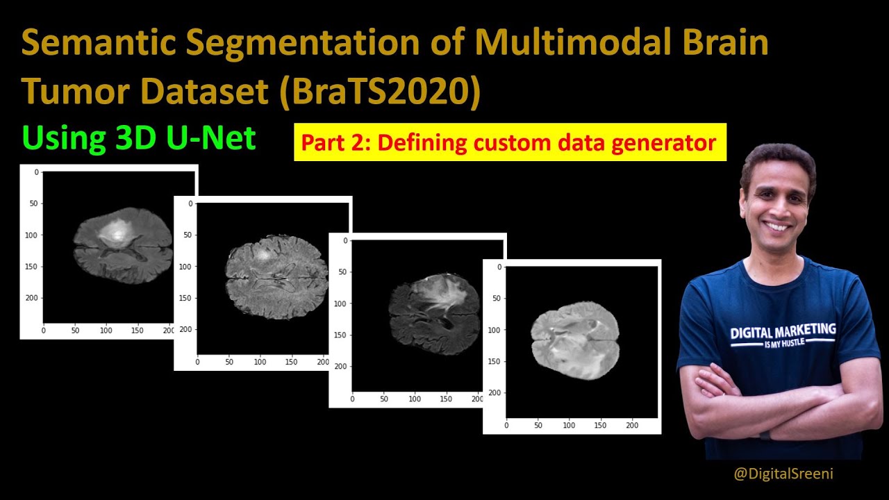 233 - Semantic Segmentation Of Brats2020 - Part 2 - Defining Your Custom Data Generator