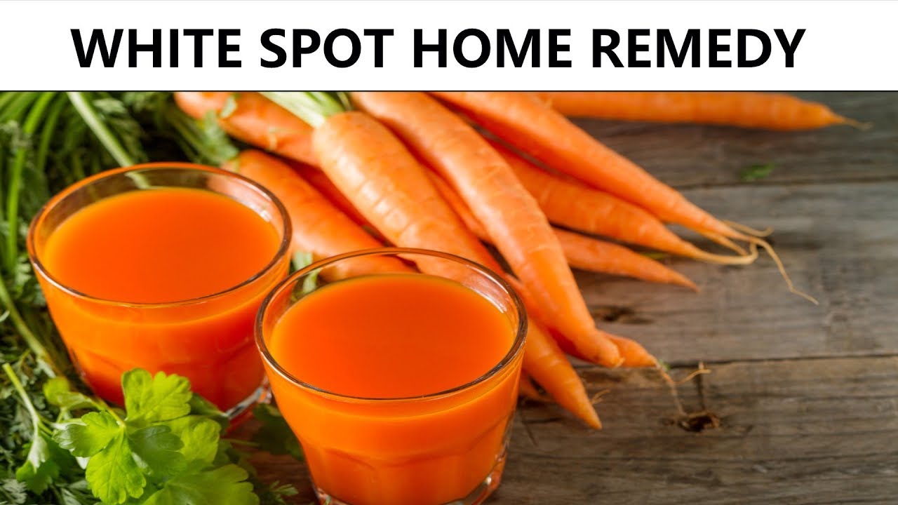 WHITE SPOTS on Skin Natural Home Remedy Trunky YouTube