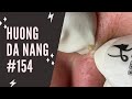 #154 | Huong Da Nang