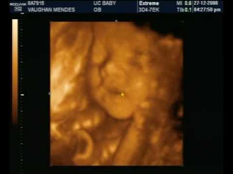 Ultra Som Em 3d 7 Meses Rodrigo Mendes Youtube