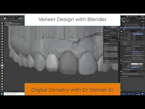 Veneer Design with Blender Software