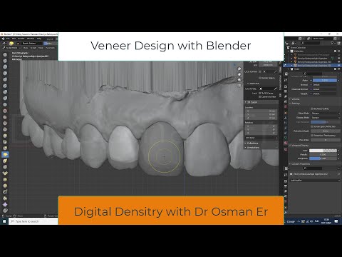 Veneer Design With Blender Software