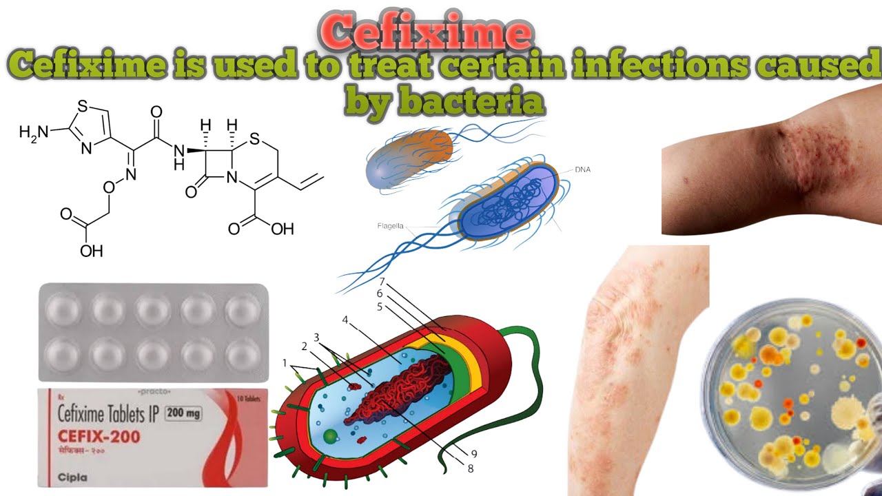Cefixime || Cefixime Uses || How Cefixime works || Common side effects  ||EXPERT ADVICE FOR CEFIXIME