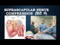 कंधे की नस दब जाना Suprascapular Nerve Compression Hindi