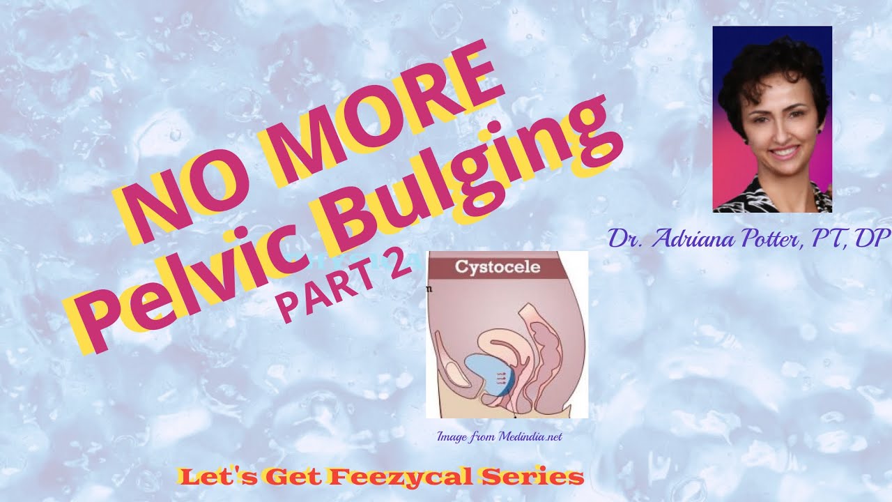 No more Bulging Part 2– Addressing Pelvic Prolapse with Pelvic Floor Exercises
